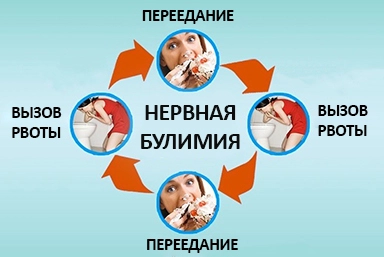Лечение булимии в Александровск-Сахалинском